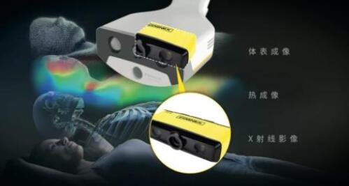 康耐視3D-A5060三維面陣視覺系統(tǒng)助力精準(zhǔn)放療，實(shí)現(xiàn)人體定位監(jiān)控新維度(圖1)