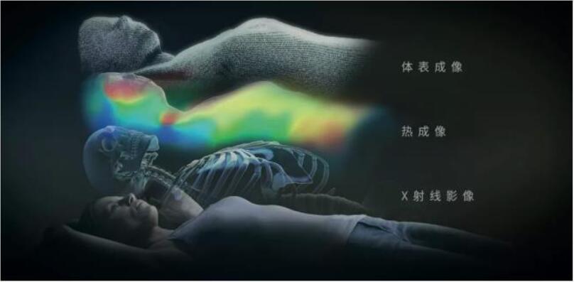 康耐視3D-A5060三維面陣視覺系統(tǒng)助力精準(zhǔn)放療，實(shí)現(xiàn)人體定位監(jiān)控新維度(圖3)